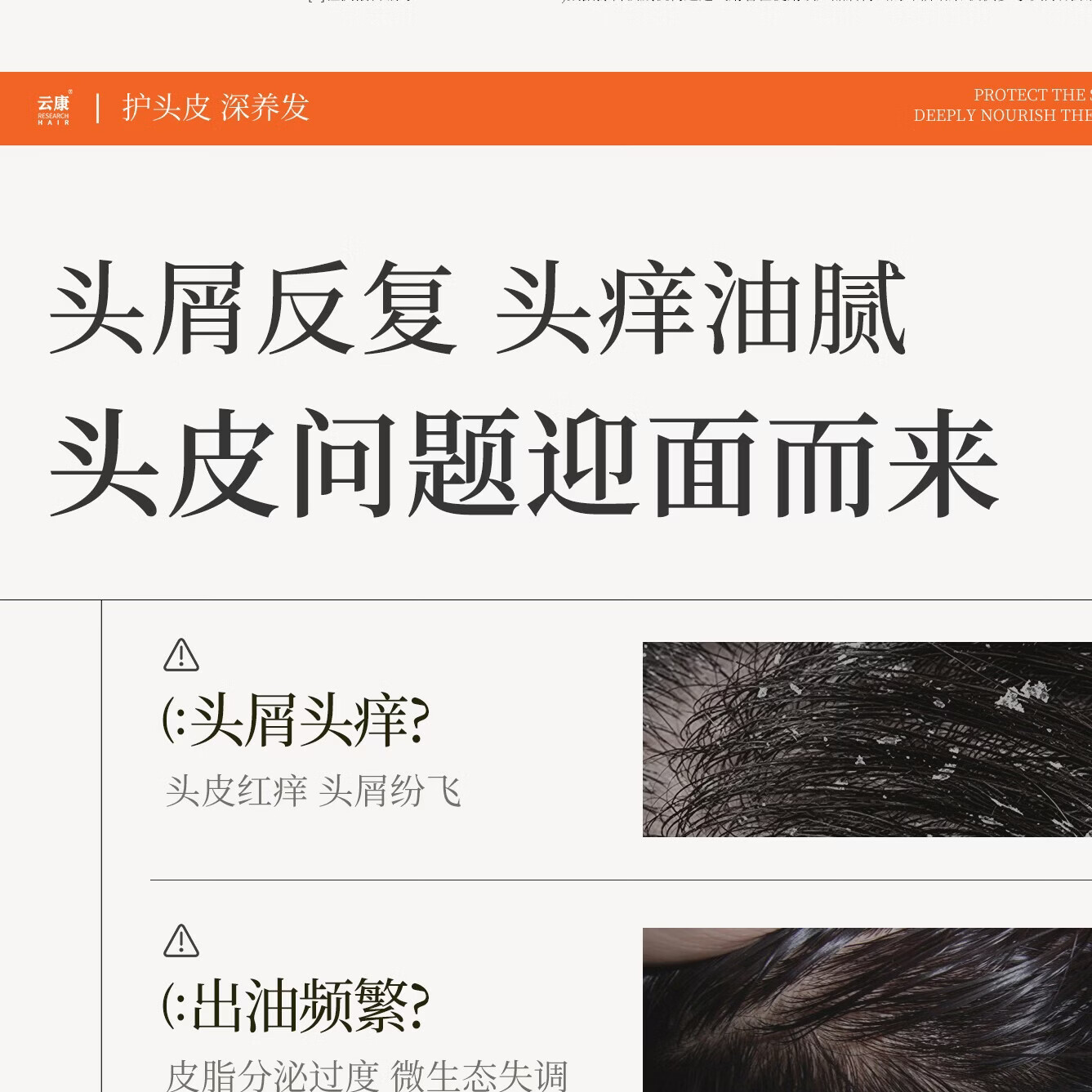 云康升级去屑止痒护发洗发水二硫化硒持久蓬松控油留香洗头膏液露洗剂 全新配方二硫化硒重度问题头屑【调理头皮环境】330g
