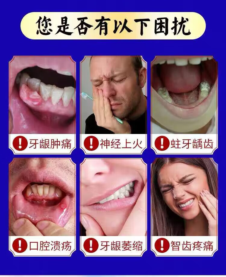 澳德力康止l痛速去牙l疼上火牙l痛宁喷剂蛀虫牙龈肿痛消l炎牙神经痛 买3+2【五盒巩固装】