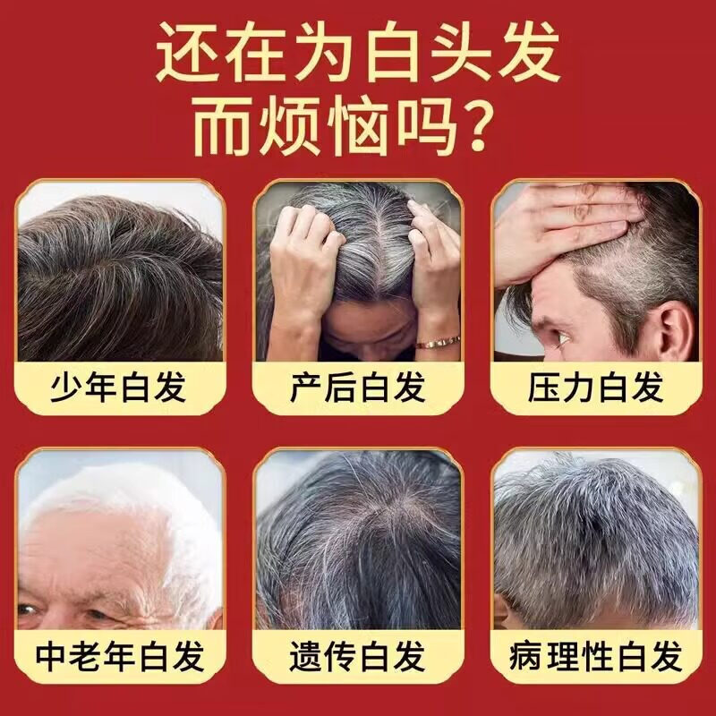 南京同仁堂黑灵芝何首乌黑发洗发水养发白发转变黑发根一洗黑发密发柔顺头发 5瓶