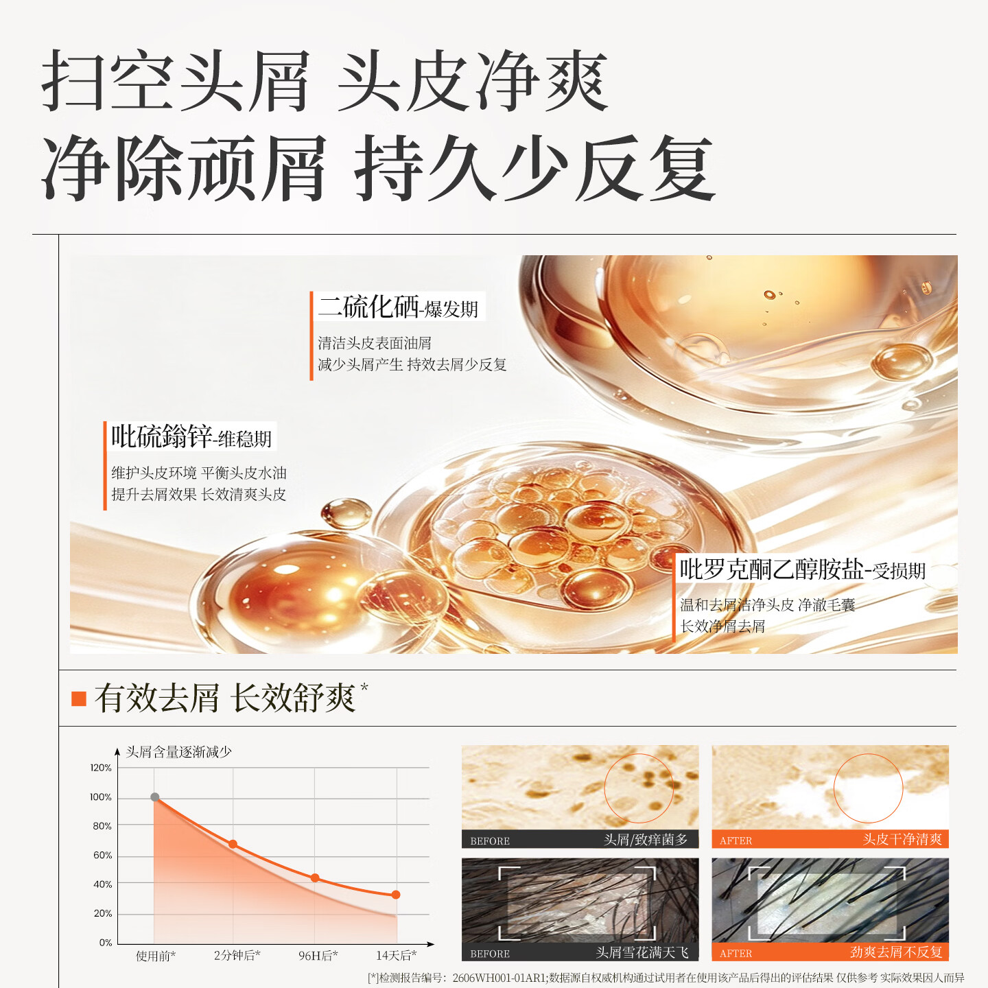 云康升级去屑止痒护发洗发水二硫化硒持久蓬松控油留香洗头膏液露洗剂 全新配方二硫化硒重度问题头屑【调理头皮环境】330g