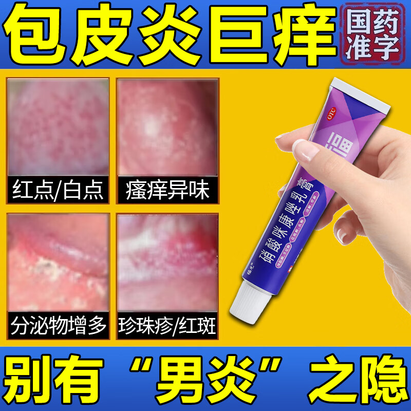 念珠菌男性包皮炎症药膏 硝酸咪康唑乳膏男人私处用药龟头炎专用药
