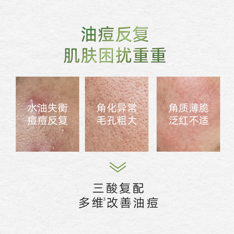 Watsons【屈臣氏】PRO精华液系列 护肤品新品 复合酸控油毛孔收敛精华液 【祛痘细腻】 30g