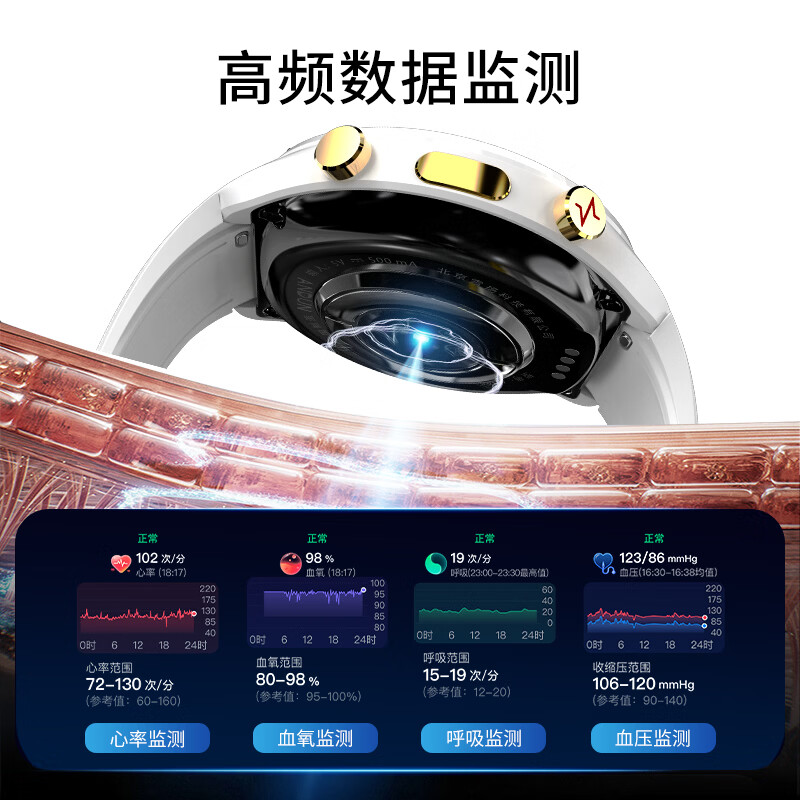 安顿生命预警表新品5X智能健康预警手表心梗脑卒中风险趋势监测手表心率血氧健康手表送父母老人礼物 5X白马骑士-云雾白+赠表带-36项服务 京仓发