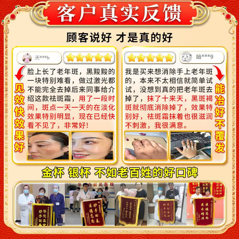 北京协和医学院祛斑霜老年斑专用特效非药一夜消去老年斑的药强力祛除手背部脸部 特效5盒膏【永久不犯】 医用净斑膏点斑药水除老年斑男士淡化黑色素日本进口