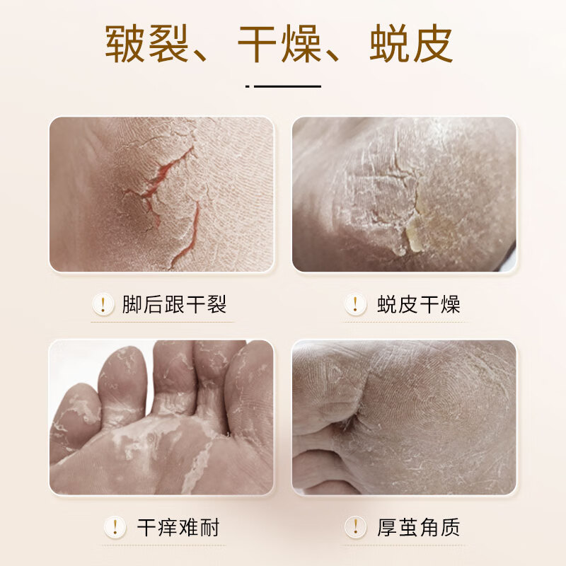 三栖虎VRZNNE马油手足润护霜防裂膏脚裂手裂皲裂膏滋润脚后跟干裂马 100g2瓶防裂膏(实惠装)