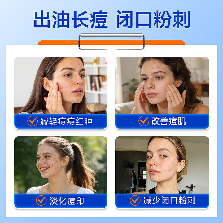 FINACEA澳版15%壬二酸祛痘凝胶黑头痘闭口粉刺皮肤炎症收缩毛孔淡化痘印 澳版壬二酸15%祛痘凝胶30g*1支 正品保障 保证正品/海外批量采购云仓/极速发出/不等待不卡关