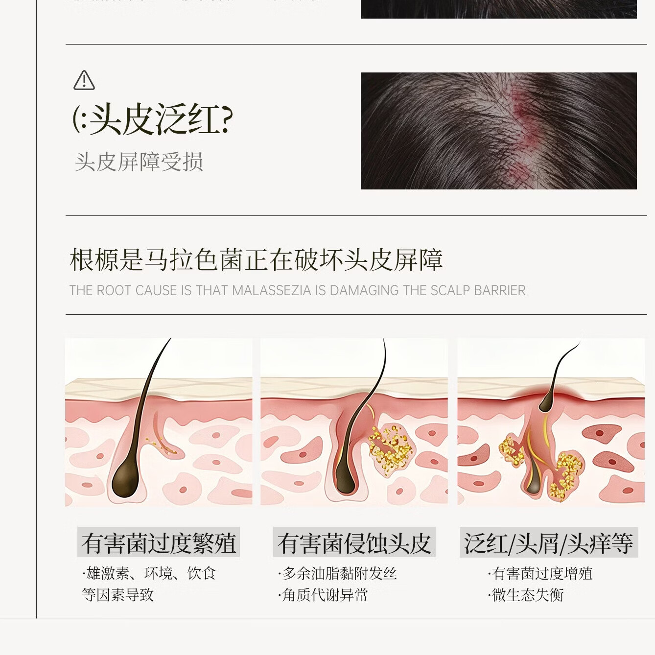 云康升级去屑止痒护发洗发水二硫化硒持久蓬松控油留香洗头膏液露洗剂 全新配方二硫化硒重度问题头屑【调理头皮环境】330g