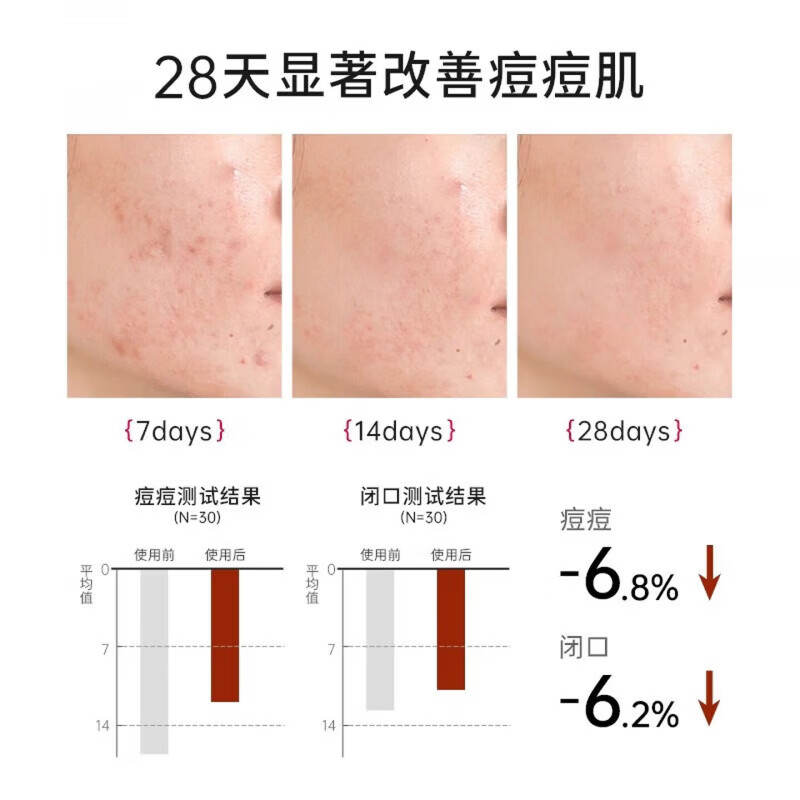 MIKLIK祛痘精华温和去青春痘消印补水嫩滑学生党身体护理套装 毛孔收缩【3瓶装】 祛痘精华液