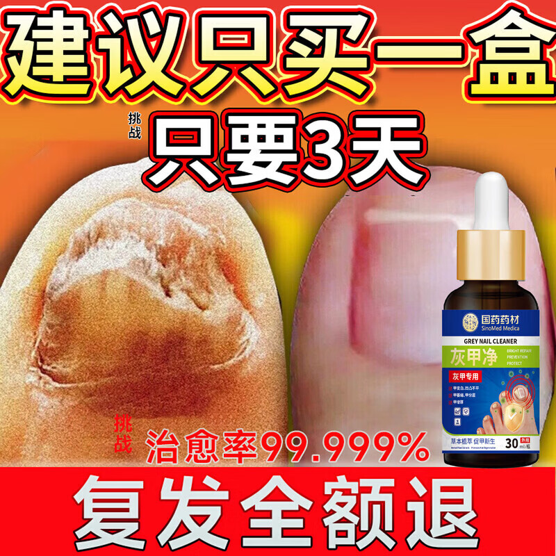 重度灰指甲100%特效专用的药特殊效专用抑菌液灰甲净套装 一盒装【1-2个灰甲】 灰指甲100%特效专用的药第一名