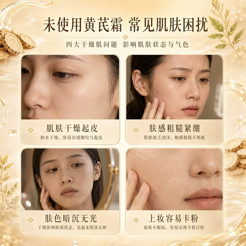 GINBI黄芪霜老牌国货经典护肤品男女士通用保湿补水改善肌肤身体乳霜 黄芪霜70g -3瓶