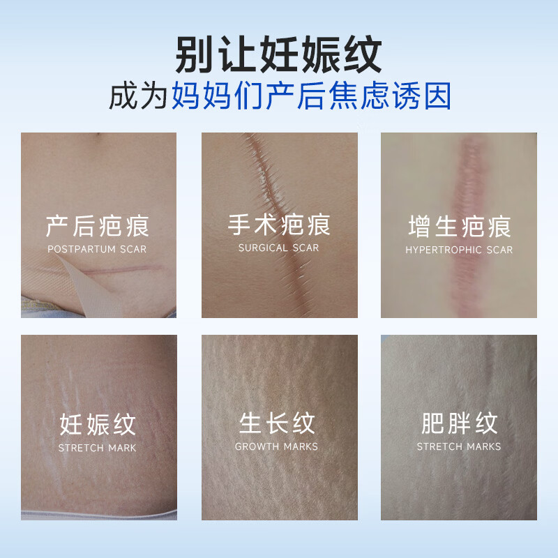 普迈迪产后疤痕修复凝胶妊娠纹祛疤膏霜剖腹产去深层修复疤痕 【剖腹产疤痕】3支装