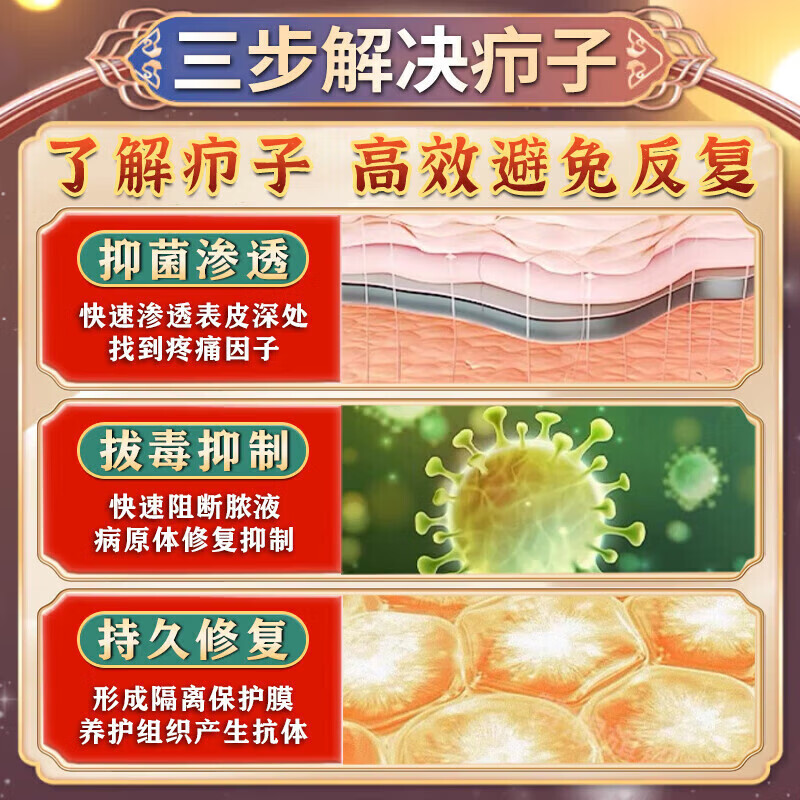 圣鑫堂火疖子吸脓贴消脓包疙瘩皮脂腺囊肿硬块火疖子专用软膏拔毒 特效买二送一【发三盒】秒拔疖子 鱼石脂消炎拔脓膏