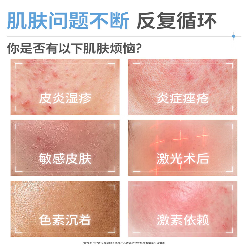 益肤【械字号】医用透明质酸敷料微创术后炎症痤疮皮炎湿疹非面膜蓝膜 2片