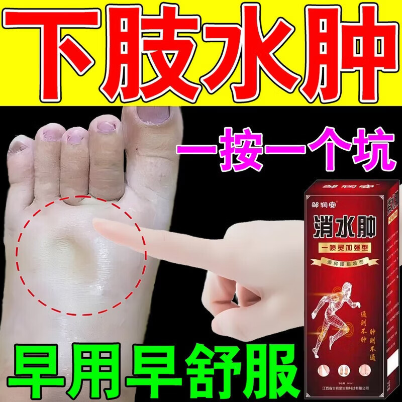 邹润安消水肿喷剂下肢水肿鼓包浮肿脚肿久坐久站中老年人腿脚水肿喷剂 五盒装【买3送2到手五盒】