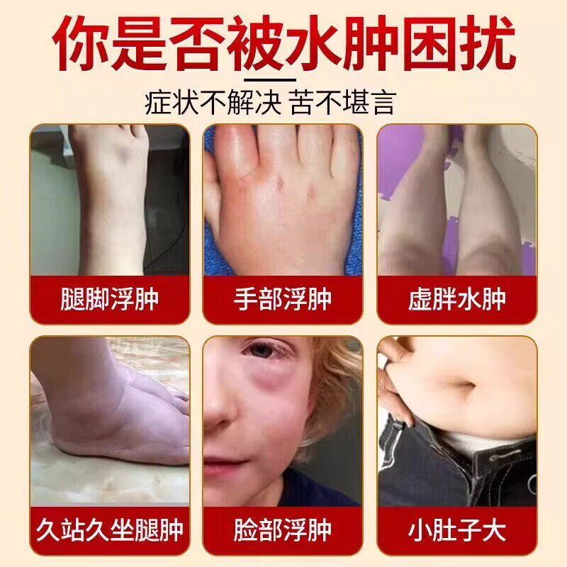 邹润安脚肿消肿喷药老年人水肿喷剂治老人去下肢浮肿脚踝肿胀专用喷雾剂 5盒装