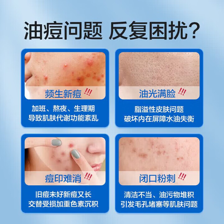 FINACEA澳版15%壬二酸祛痘凝胶黑头痘闭口粉刺皮肤炎症收缩毛孔淡化痘印 澳版壬二酸15%祛痘凝胶30g*1支 正品保障 保证正品/海外批量采购云仓/极速发出/不等待不卡关