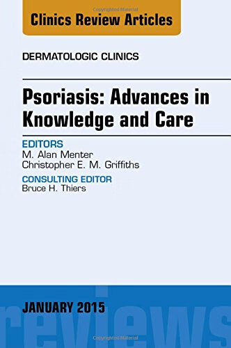 预订 psoriasis