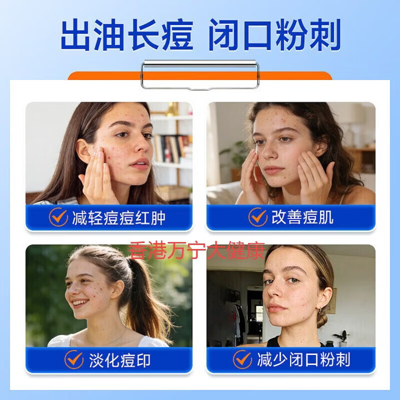FINACEA15壬二酸祛痘凝胶黑头痘痘闭口粉刺皮肤炎症收缩毛孔化痘印痤疮 澳版 壬二酸15祛痘凝胶30g*3支  活动价 正品进口澳版 壬二酸乳膏