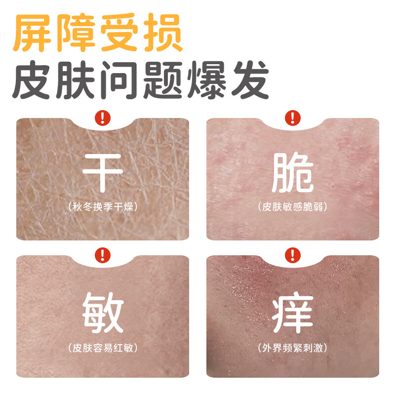 袋鼠杰克儿童保湿滋润面霜秋冬专用保湿霜蛋黄油精华霜宝宝婴幼儿润肤乳 【舒缓干敏红】蛋黄油精华霜500g*1瓶