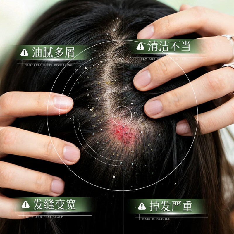 澳楠【央妈力荐】乌斯曼草侧柏叶发膜植萃护发改善干枯毛躁烫染修护 澳楠乌斯曼草侧柏叶发膜*3瓶