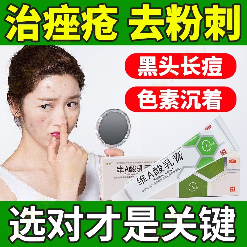 a酸软膏鸡皮肤原理(维a酸软膏能治鸡皮肤吗) a酸软膏鸡皮肤原理(维a酸软膏能治鸡皮肤吗)