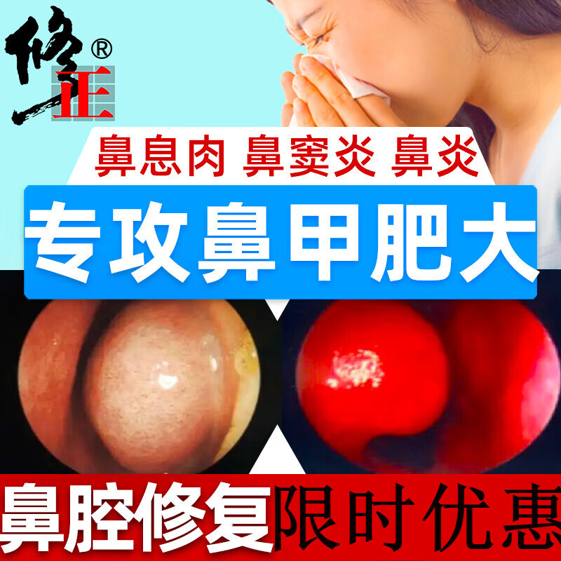 【药房直售】鼻甲肥大鼻息肉过敏性鼻炎喷雾喷剂专用根黏膜修复鼻塞通