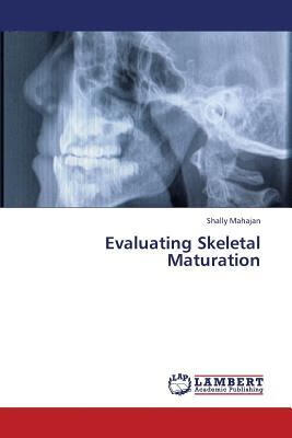 预订evaluating skeletal maturation