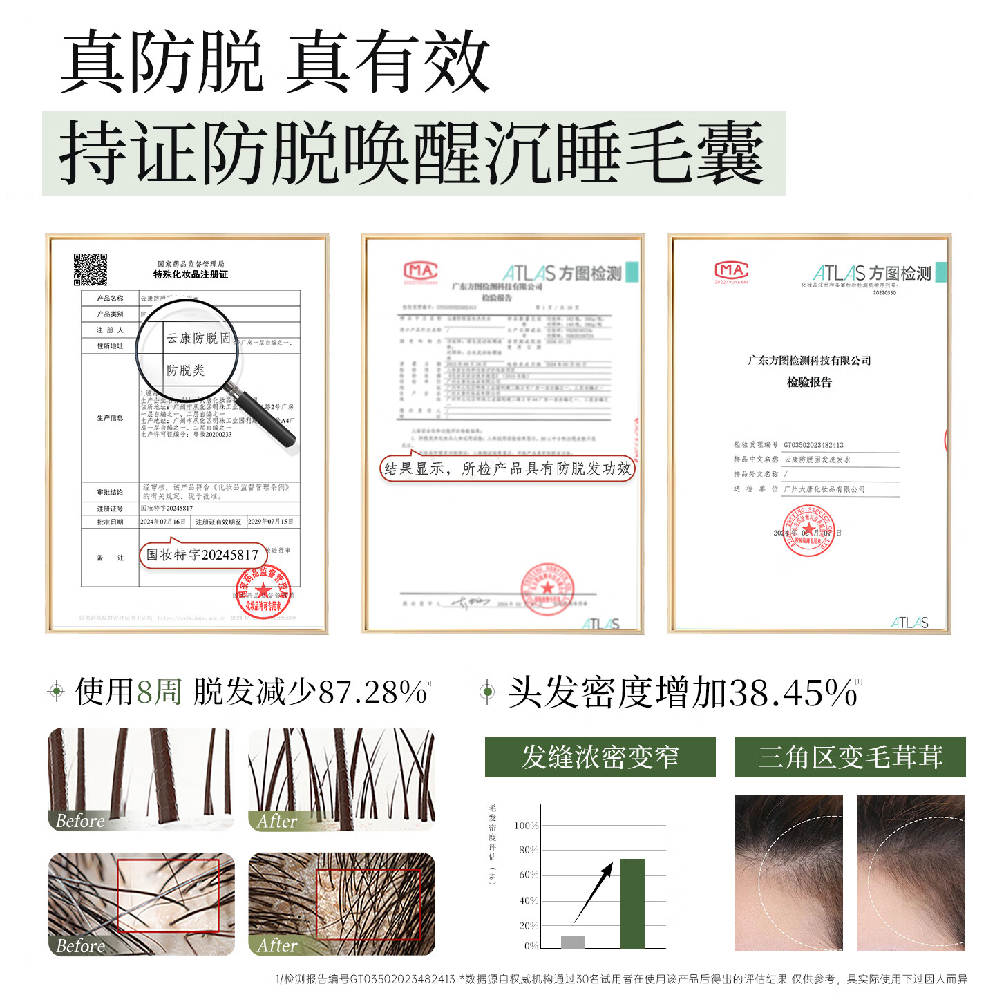 云康防脱固发洗发水蓬松柔顺草本防断洗发露盈韧学生洗头膏男女正品 【科学防脱】330G*1瓶