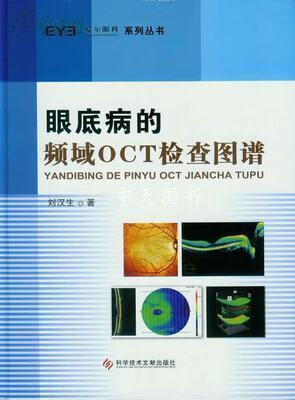 眼底病的频域OCT检查图谱 刘汉生著 科学技术文献出版社