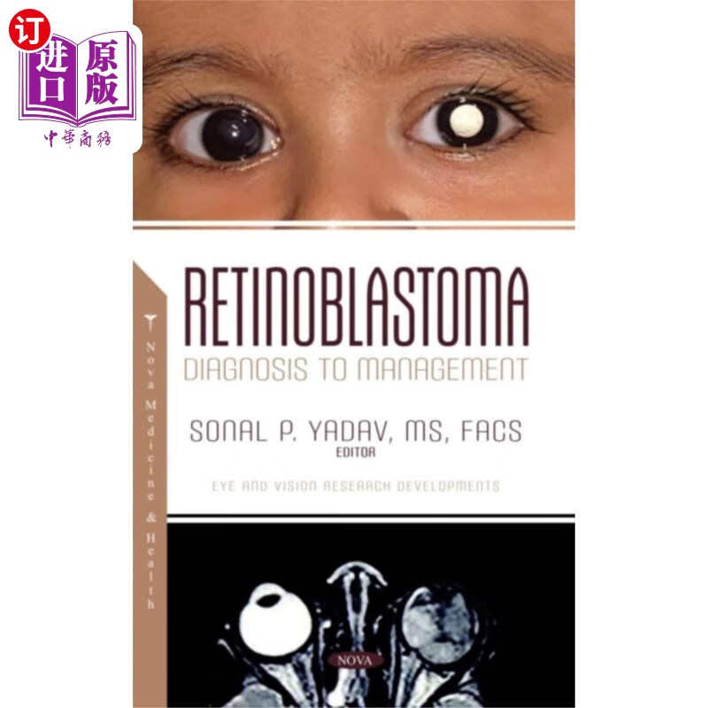 海外直订医药图书retinoblastoma 视网膜母细胞瘤