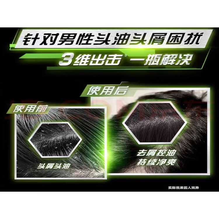 清扬洗发水750g男士清爽控油去屑洗发露家庭实惠装 男士清爽控油750g