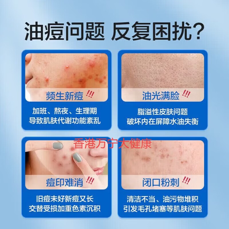 FINACEA15壬二酸祛痘凝胶黑头痘痘闭口粉刺皮肤炎症收缩毛孔化痘印痤疮 澳版 壬二酸15祛痘凝胶30g*3支  活动价 正品进口澳版 壬二酸乳膏