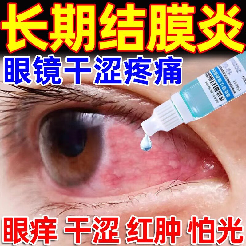 慢性结膜炎眼药水眼睛痒眼干眼涩怕光流泪眼疼红血丝眼干眼涩眼药水抗