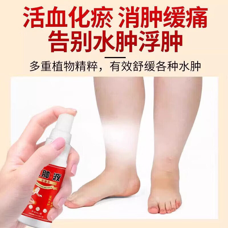 邹润安脚肿消肿喷药老年人水肿喷剂治老人去下肢浮肿脚踝肿胀专用喷雾剂 5盒装