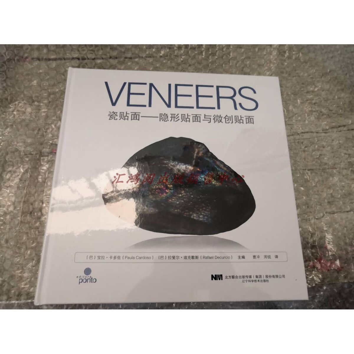 瓷贴面—隐形贴面与微创贴面