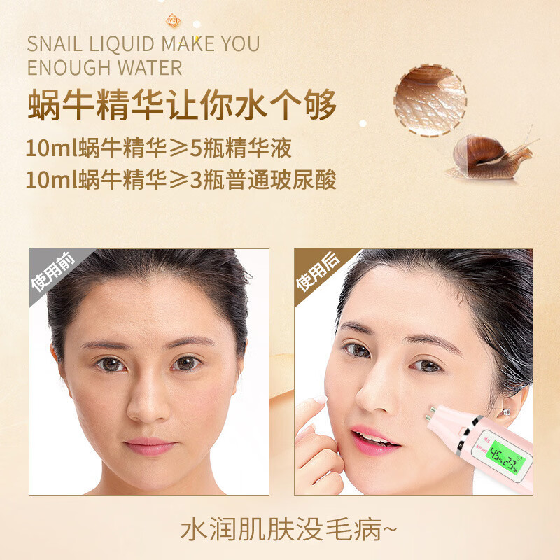 FHUAY八杯水保湿补水化妆品套装抗皱紧致水乳焕白去黄祛痘印控油女护肤 蜗牛补水保湿水嫩养肤护肤品