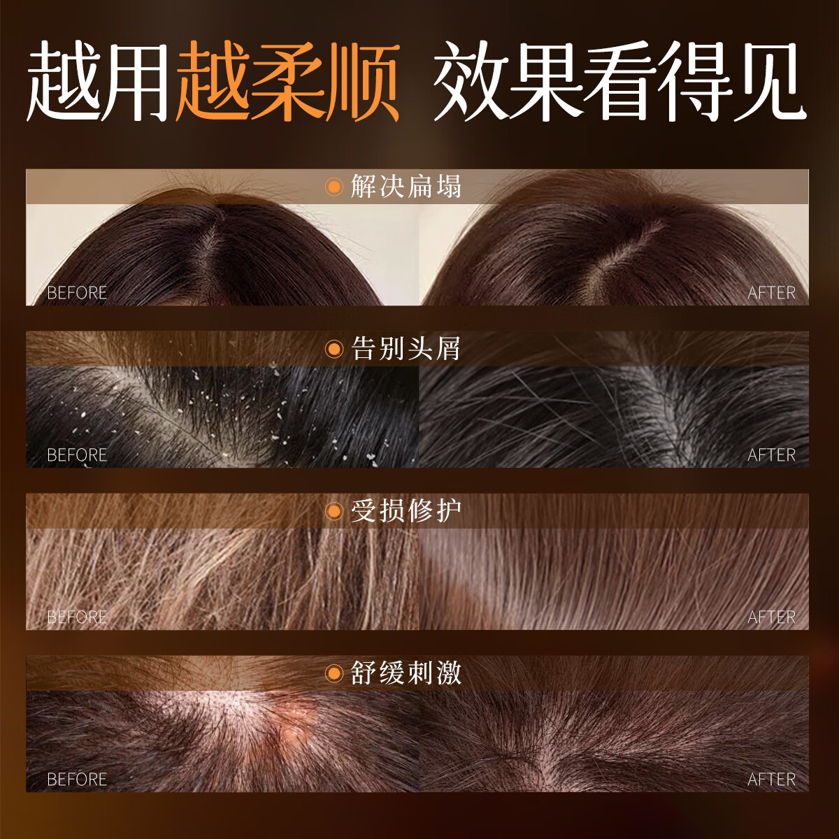 宫芙洗发水控油去屑持久蓬松男士女士专用洗头水香氛胶原多肽洗发液 【控油去屑】颅顶蓬蓬洗发水380ml*1瓶