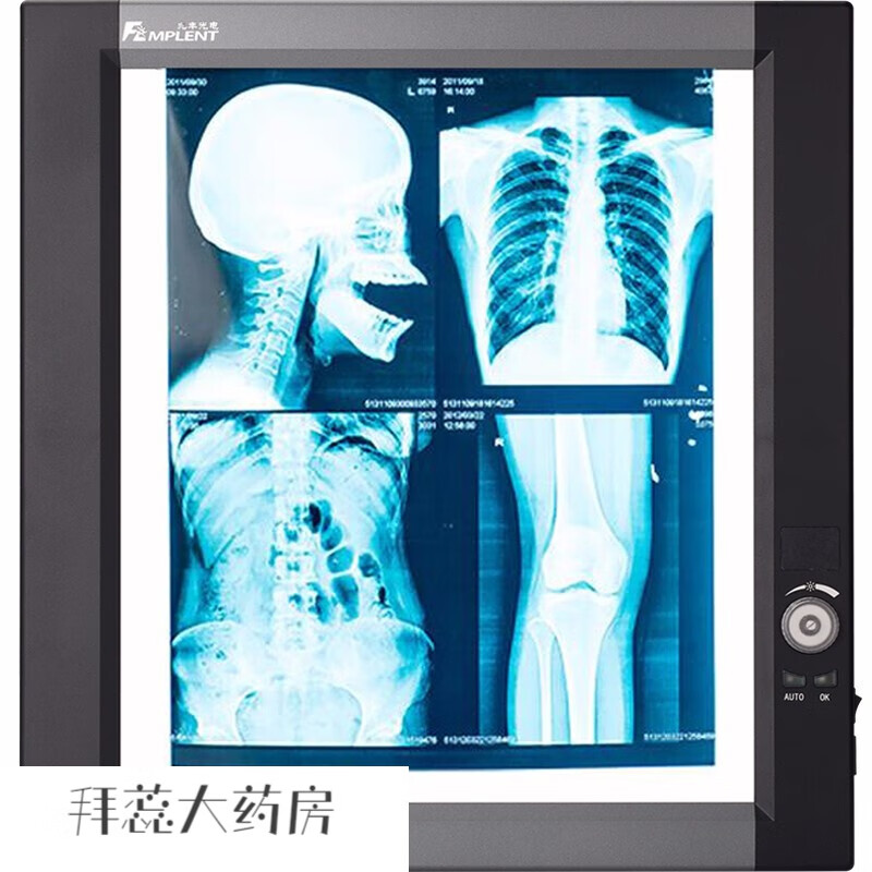 医用led观片灯箱单联多联射线胶片观片灯医用检查骨科x光片看片察 单