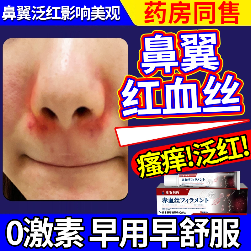 药房同售鼻子红血丝辅助修复凝胶鼻子两边红鼻头发红起皮发痒两侧增厚