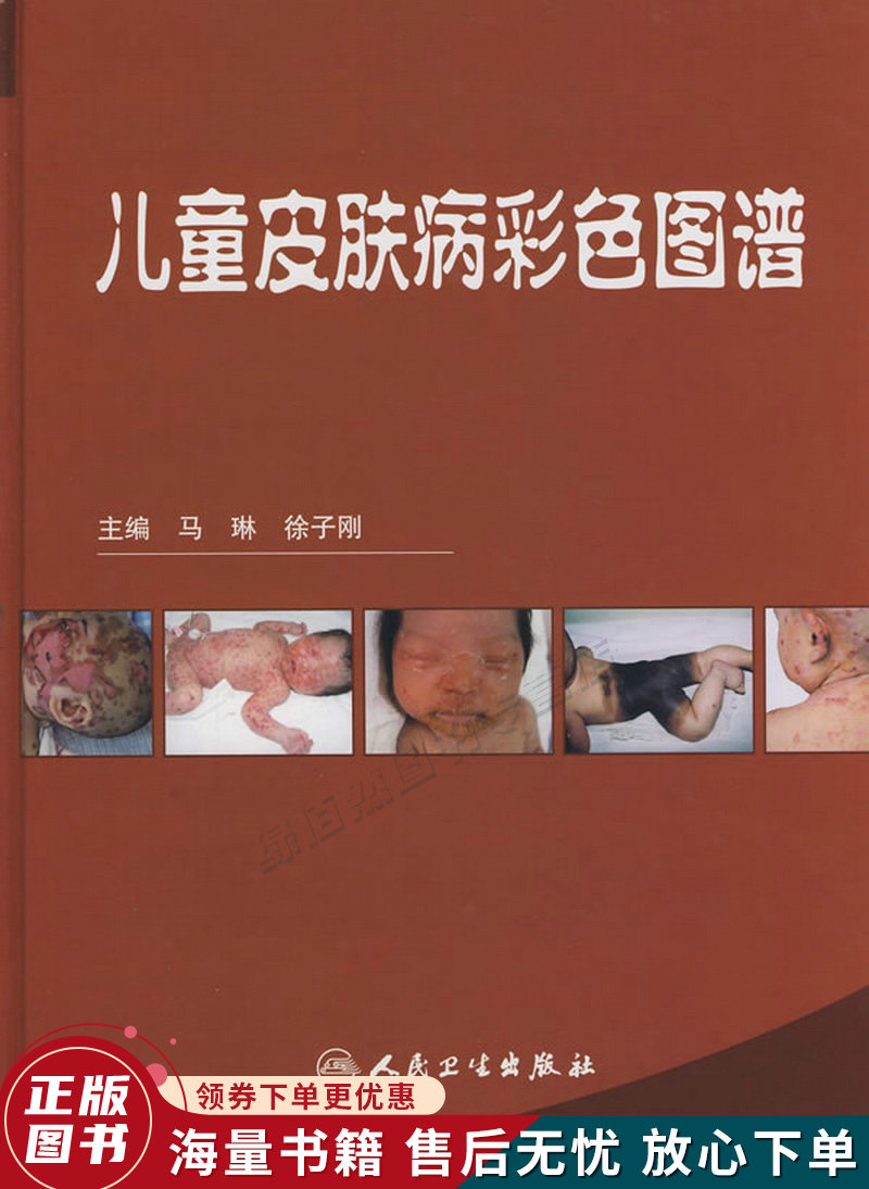 儿童皮肤病彩色图谱