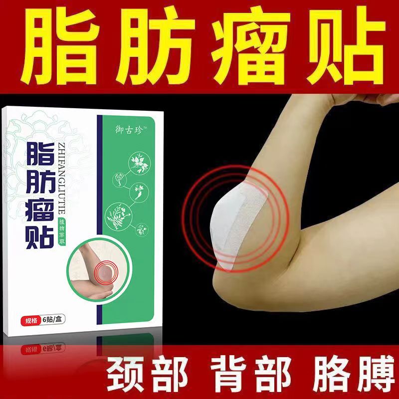 脂肪瘤贴膏去除皮下脂肪留硬块全身发多性单发性贴消瘤膏 一盒体验装