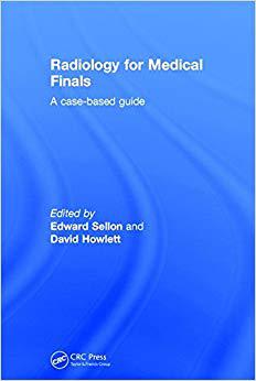 【预订】radiology for medical finals