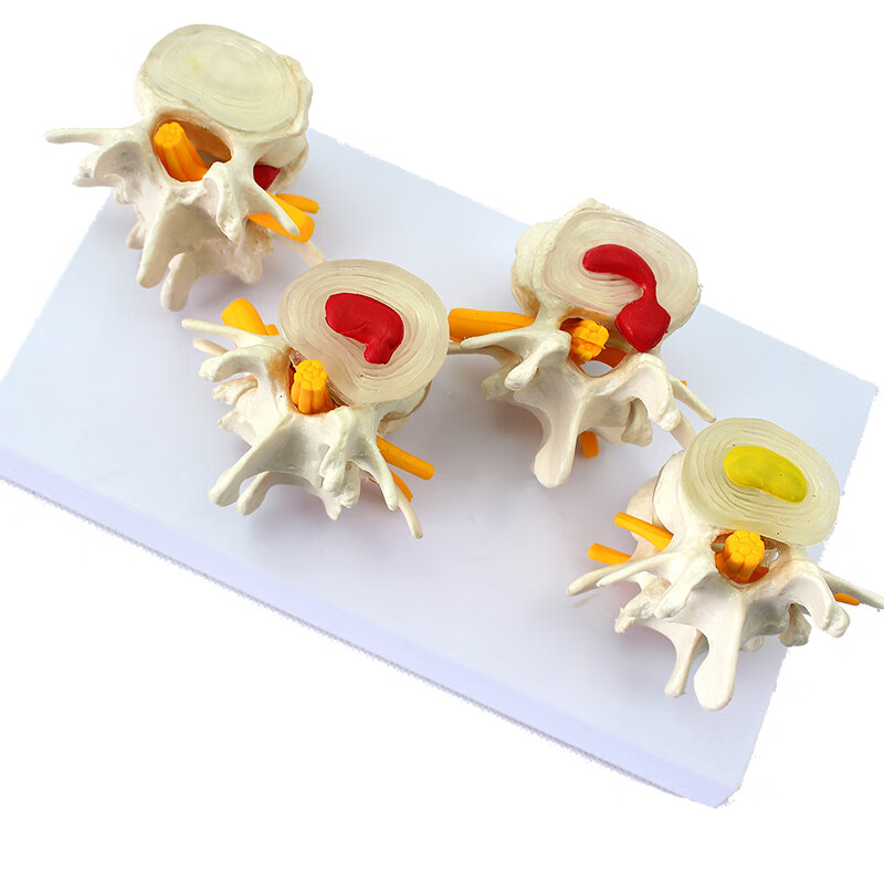 科膝关节疾病半月板十韧带软骨组织韧带结构模型骨科手术摸拟医患沟通