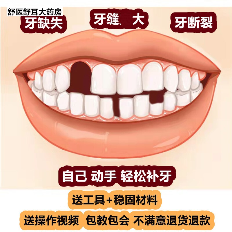 一颗牙齿自补临时牙材料自制树脂假牙仿真牙断裂牙缝家用 5克(工具+稳固剂) 第八代可做5颗牙