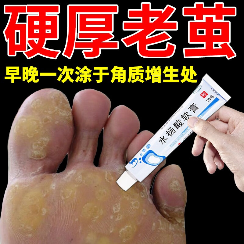 水杨酸软膏老茧软化膏 老茧脚死皮脚后跟硬皮脚掌脚底脚垫手茧子 1盒