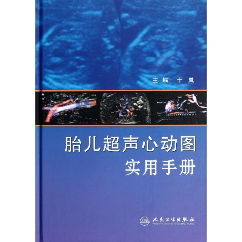 胎儿超声心动图实用手册 于岚 编 影像医学生活 人民卫生出版社