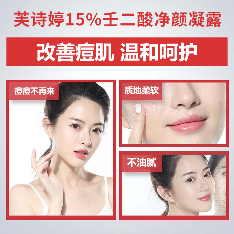 芙诗婷壬二酸15%凝胶乳膏祛痘淡化痘印清洁黑头闭口粉刺油痘肌凝露软膏 3支【15%壬二酸】周期装