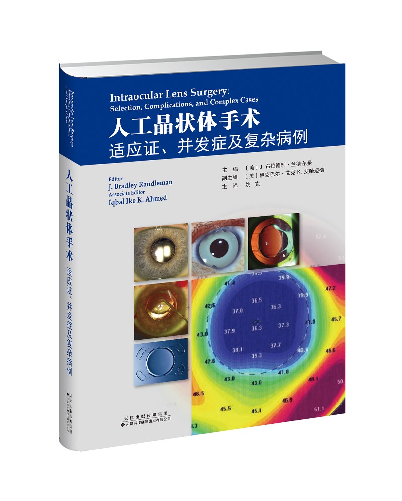 人工晶状体手术:适应证,并发症及复杂病例