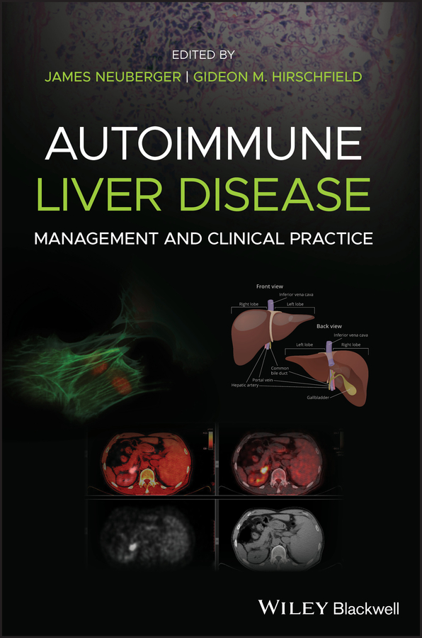 预售 按需印刷 autoimmune liver disease p