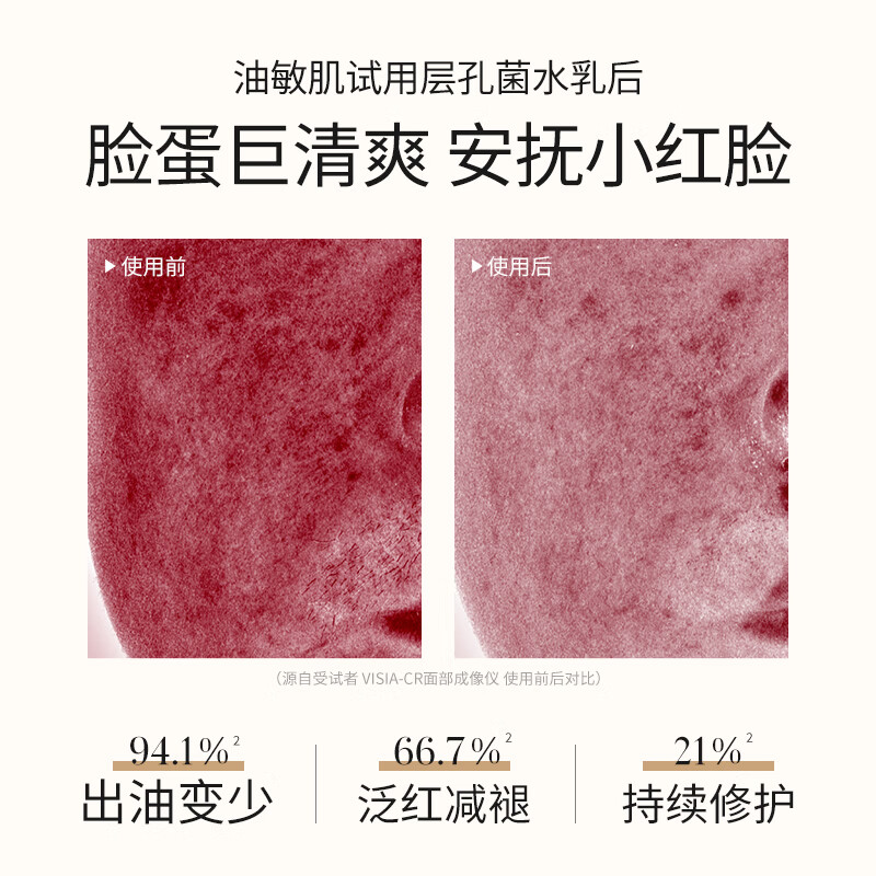 溪木源 蔡徐坤同款层孔菌水乳套装控油舒缓敏感肌补水保湿护肤品礼盒 【性价比高】水乳120ml+60ml